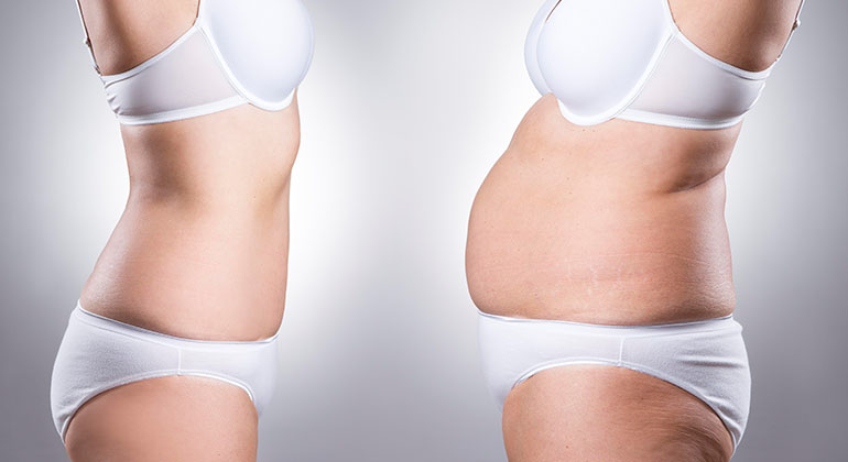 dr soner karaali karin germe 1