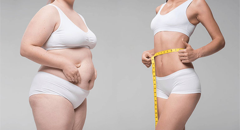 dr soner karaali liposuction 1